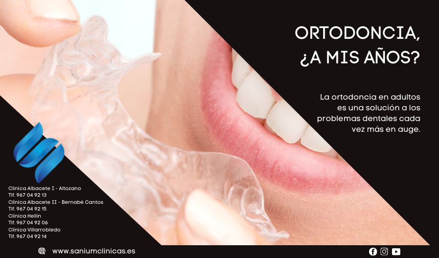 La ortodoncia en adultos es una solución a los problemas dentales cada vez más en auge