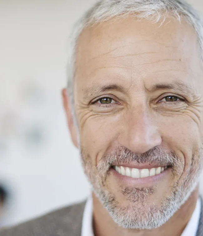 Hombre sonriendo después de un implante dental en Hellín- Sanium
