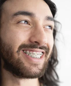 Tratamiento de ortodoncia convencional en Hellín