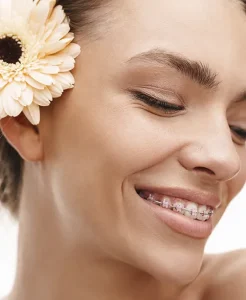 Tratamiento de ortodoncia estético en Hellín