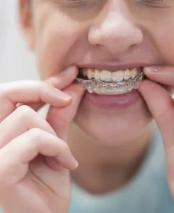 Tratamiento de ortodoncia invisible en Hellín