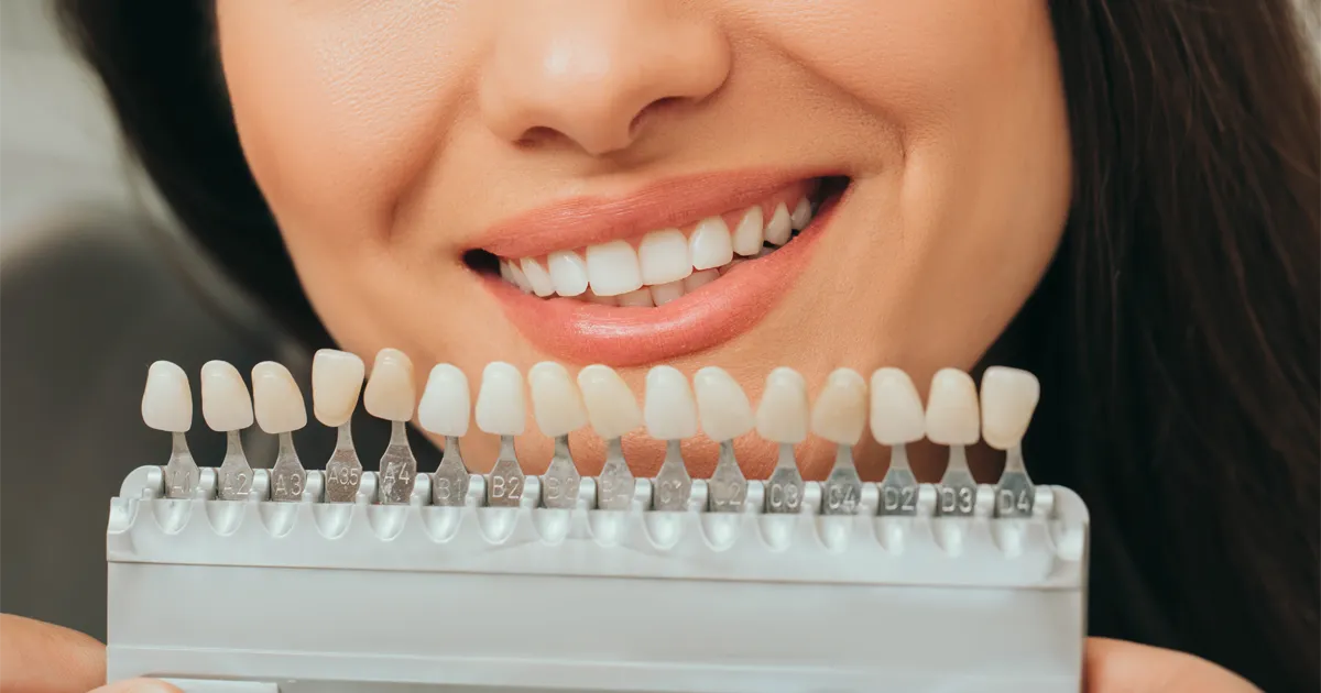 mujer sonriente despues tratamiento blanqueamiento clinica sanium albacete